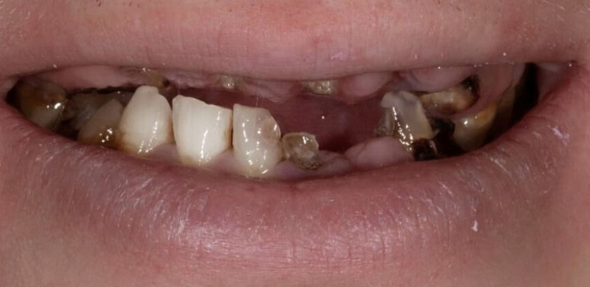 Before image
